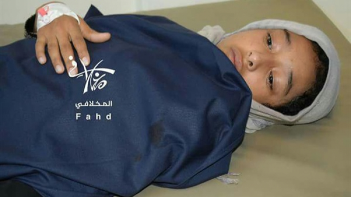شاهد بالصورة: إصابة طفلة برصاصة قناصة المليشيا في مدينة تعز