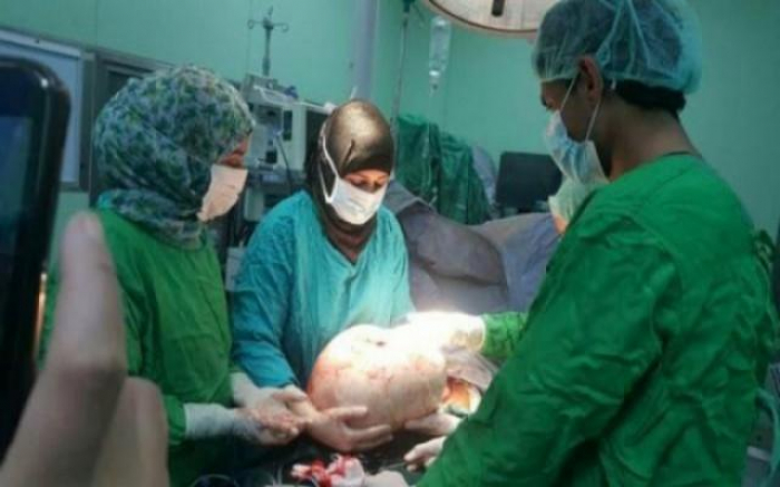 طبيبتان يمنيتان تحطمان رقما قياسيا عالميا وتدخلان موسوعة ”غينيس”