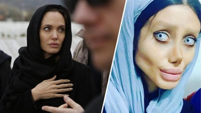 شاهد صور مرعب: هكذا أصبحت فتاة إيرانية بعدما أجرت 50 عملية تجميل لتشبه "أنجلينا جولي"