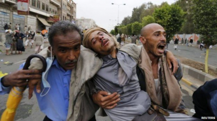 مصادر عسكرية: ارتفاع قتلى الاشتباكات بين قوات صالح والحوثيين إلى أكثر من 100 شخص