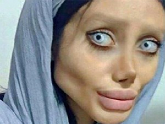 شاهد..قصة الفتاة الإيرانية شبيهة أنجلينا جولي تنتهي بصدمة