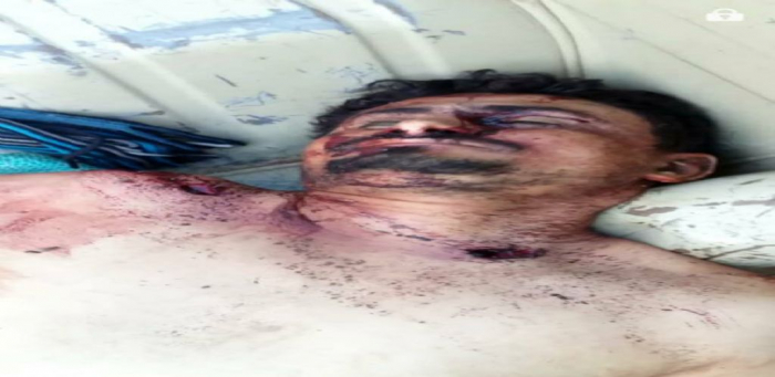 مصرع قيادي حوثي كبير في جبهة الساحل الغربي والحوثي يتستر على الخبر