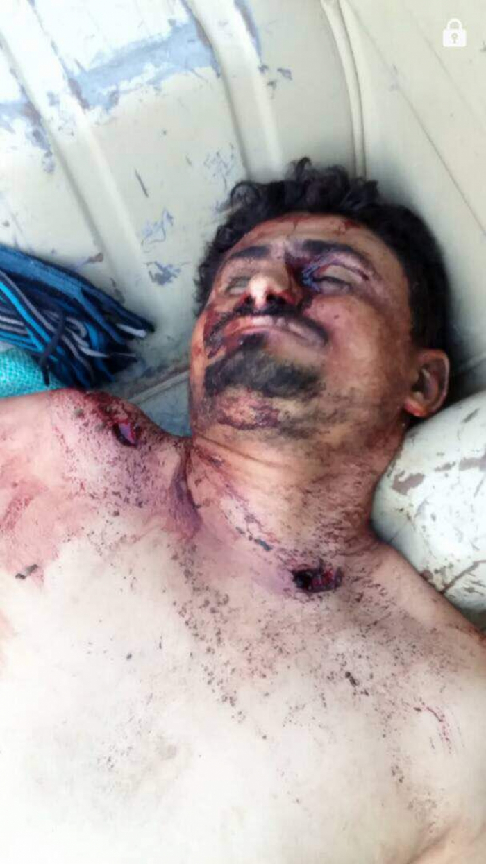 مصرع القيادي الحوثي "أبو جبريل" في جبهة الخوخة والمليشيات تتحفظ على نشر خبر مقتله ( صورة )