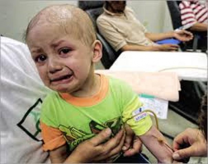 30 ألف حالة سرطان سنويا في اليمن