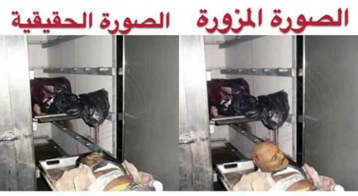 شاهد (الصورة) الحقيقية والأخيرة لجثمان المخلوع "صالح " في المستشفى