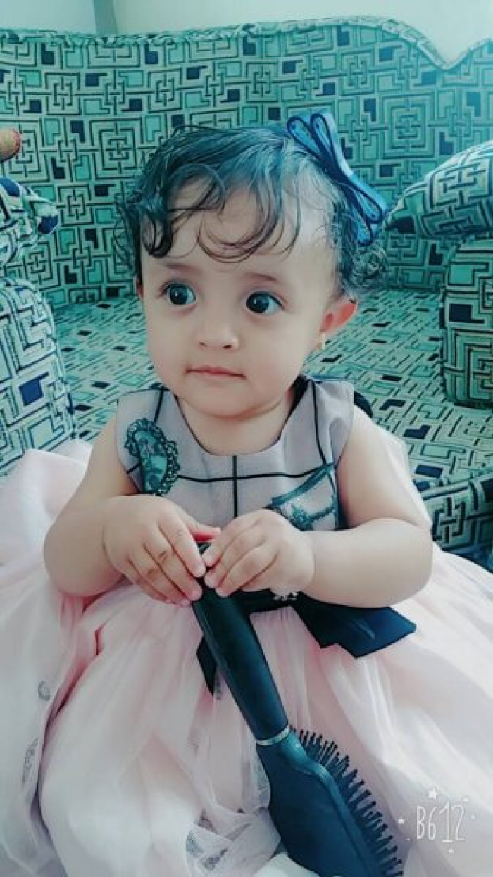 سبحان الله : هذه الطفلة توقف قلبها واعلن موتها بمستشفى في صنعاء ثم عادت الى الحياة "صورة "