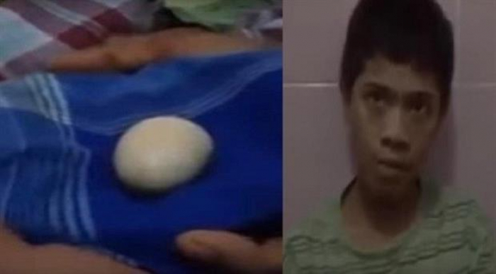 شاهد: صبي إندونيسي يبيض على مرأى من الأطباء الذين وصفوا حالته بأنها معجزة