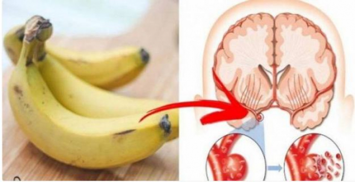 ما يحدث لكم إذا أكلتم 3 موزات في اليوم!