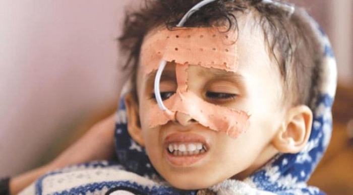 التحالف ينقل فريق طبي دولي للمكلا