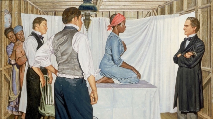 فظائع الطب ضد النساء السود..جراحات بلا تخدير وثقب جماجم