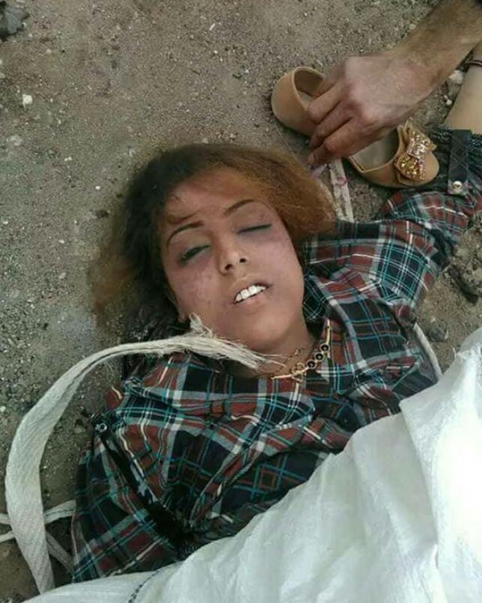 شاهد الصورة : مليشيا الحوثي تقتل شقيقة الفنان اليمني الكبير احمد فتحي لانها تصدت لهم بالحديدة