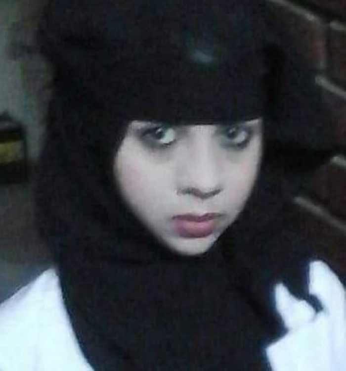 هذه قصة النازحة لميس التي اختطفها واحرقها ضابط الامن الحوثي "المنيعي"
