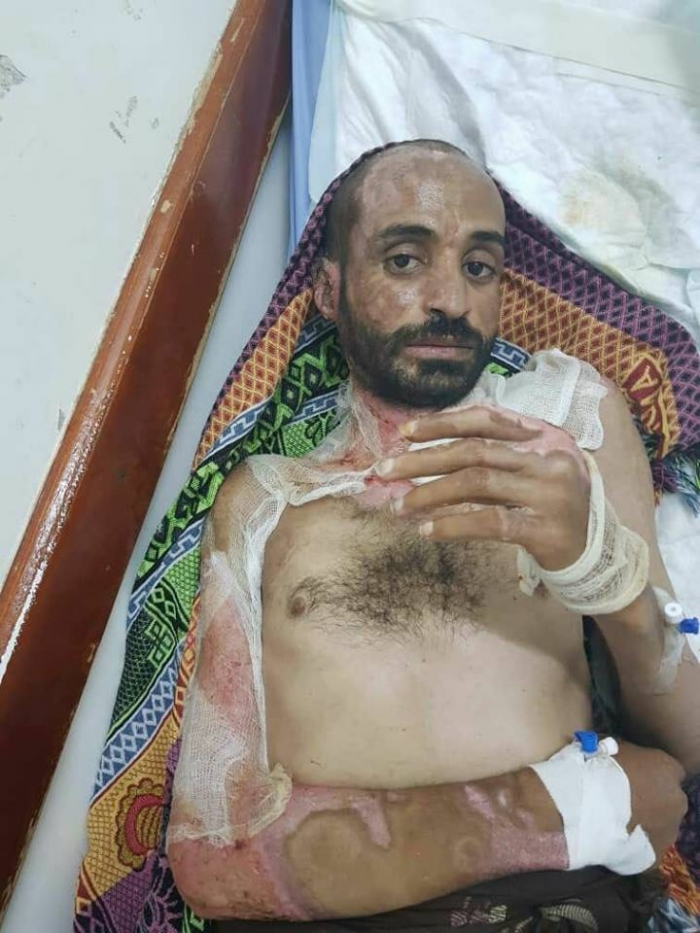 وصول المختطف منير الشرقي إلى مأرب لتلقي العلاج بعد تعرضه للتعذيب في سجون الحوثي