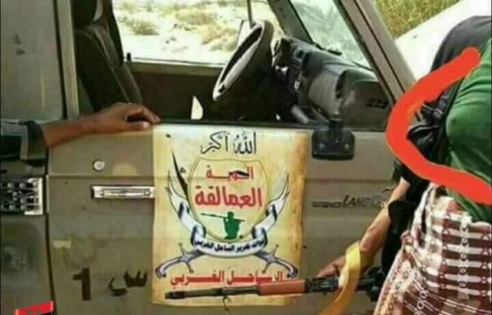 شاهد الصورة المخزية : مليشيا الحوثي تواجه قوات الشرعية بملابس وهيئة نسائية