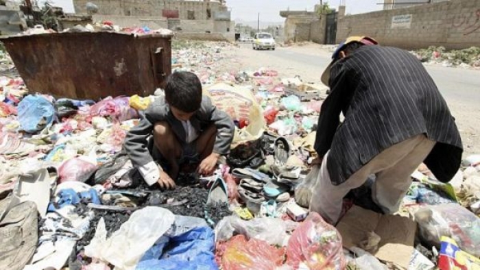 مواطن يمني يبيع كلته من اجل طعام اولاده