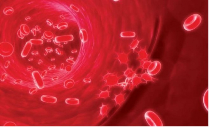 أنواع سرطان الدم "اللوكيميا" وأعراضه