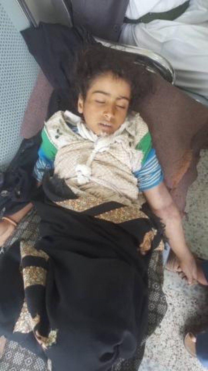 وفاة طفلة صغيرة بعد ضربها على يد والدها في صنعاء (صورة)