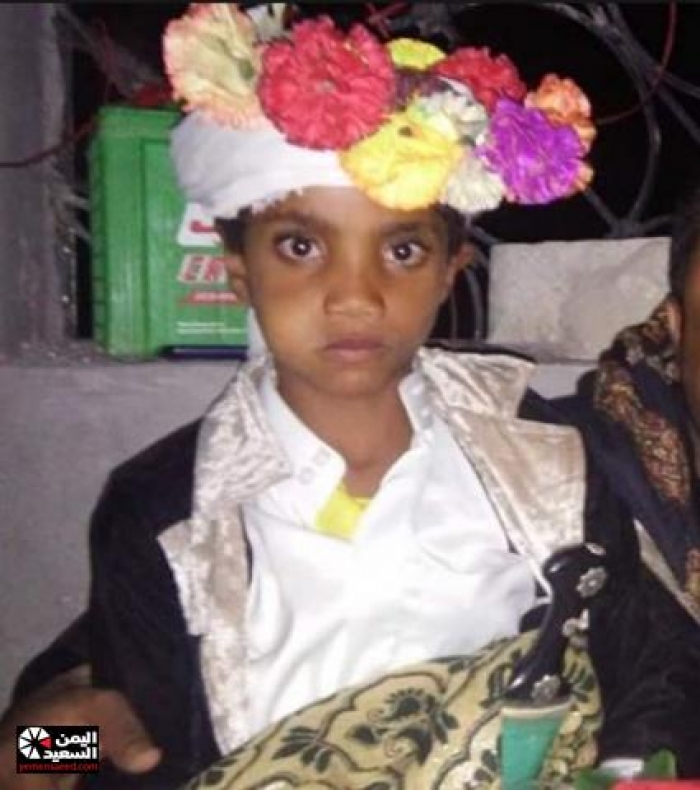 أصغر عريس في اليمن طفل في الثامنة من عمره يزف إلى عروسه في ذمار (صورة)