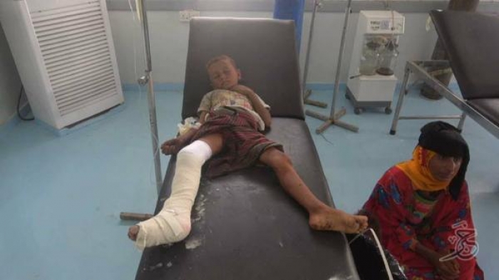 إصابة مدنيين معظمهم نساء وأطفال وشيوخ بقصف حوثي استهدف منازلهم بالحديدة