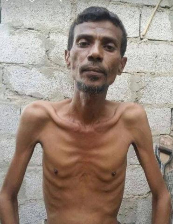 فنان يمني يموت من الجوع .. صورة