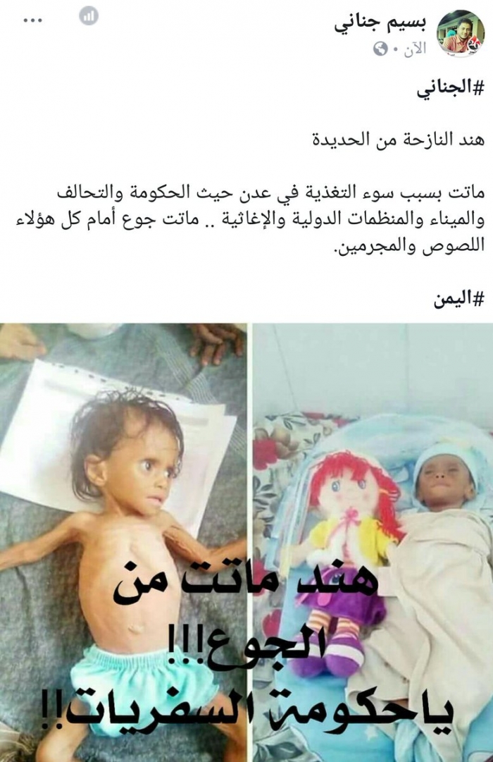 شاهد صورة صادمة لطفلة نازحة ماتت من الجوع اليوم في عدن