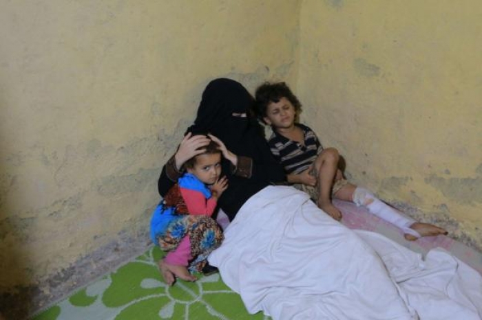 ما قصة المرأة اليمنية «أمل» التي نشرتها اللجنة الدولية للصليب الأحمر
