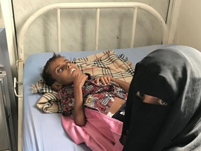 آدم.. طفل آخر يموت في اليمن ”جوعا”