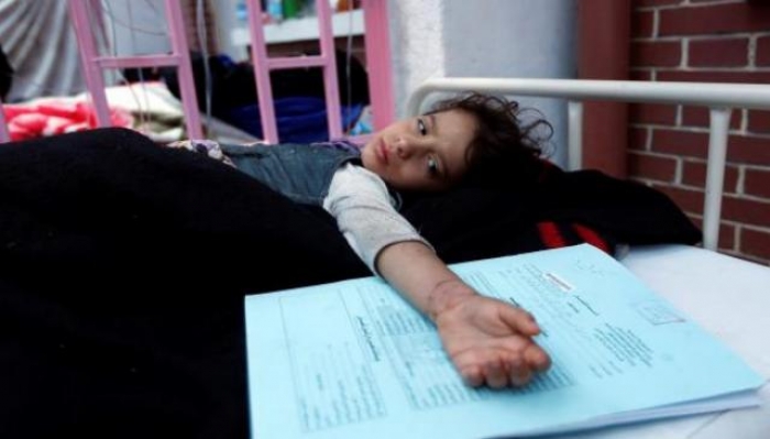 الكوليرا يفتك بقرى العدين وأزمة الحرب تتسبب بموت 85 ألف طفل يمني
