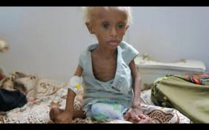الحرب على الاطفال في اليمن
