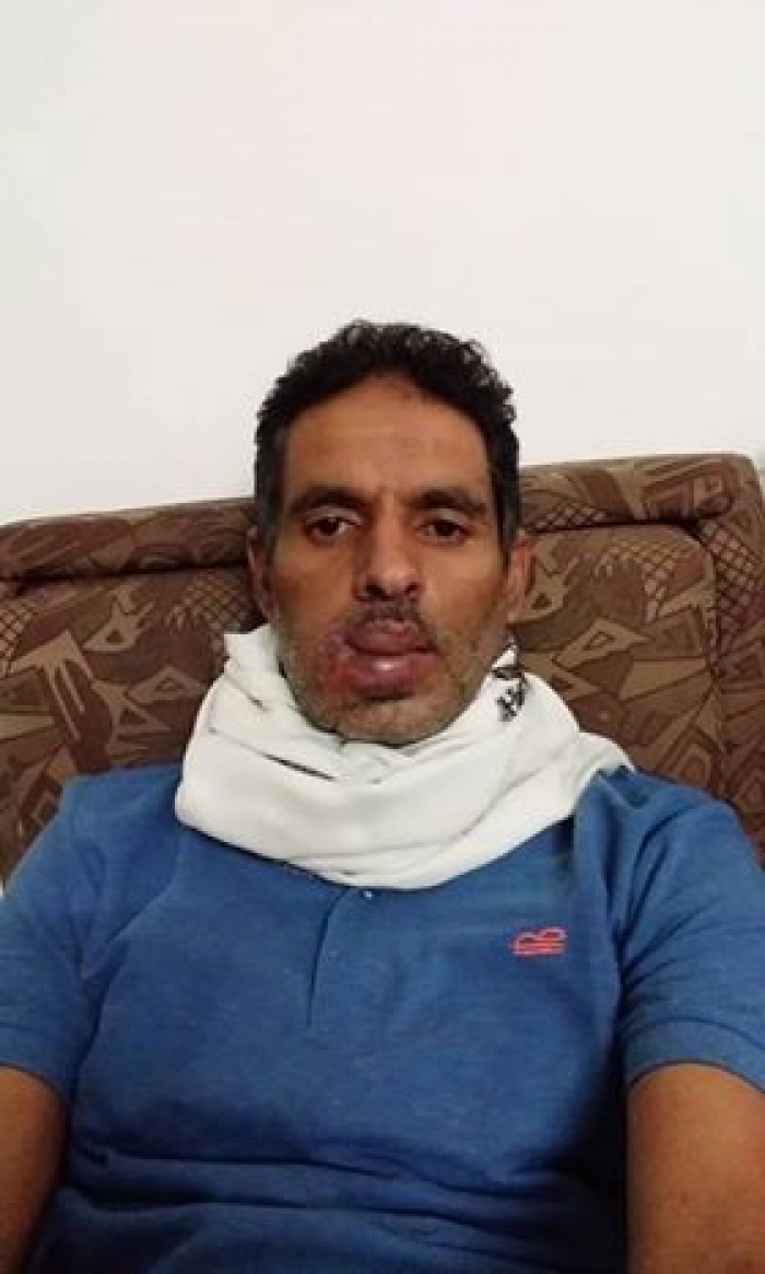 بعد نجاح العملية الثانية لاستئصال ورم خبيث: كابتن ونجم اهلي صنعاء السابق/ سامي الحيمي يجري عملية ثالثة باء الهند....