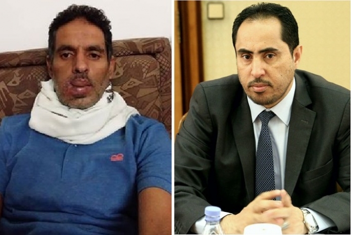 الوزير نايف البكري يطمئن على صحة نجم اهلي صنعاء ويقدم له($2000 ) مساعدة علاجية عاجلة