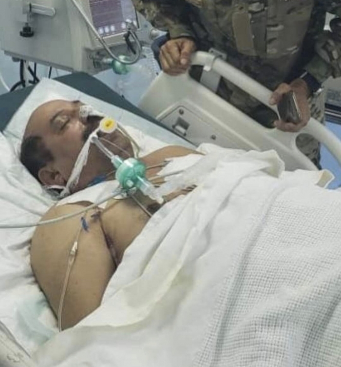 وفاة قائد عسكري يمني متأثرا بجراحه بعد هجوم العند