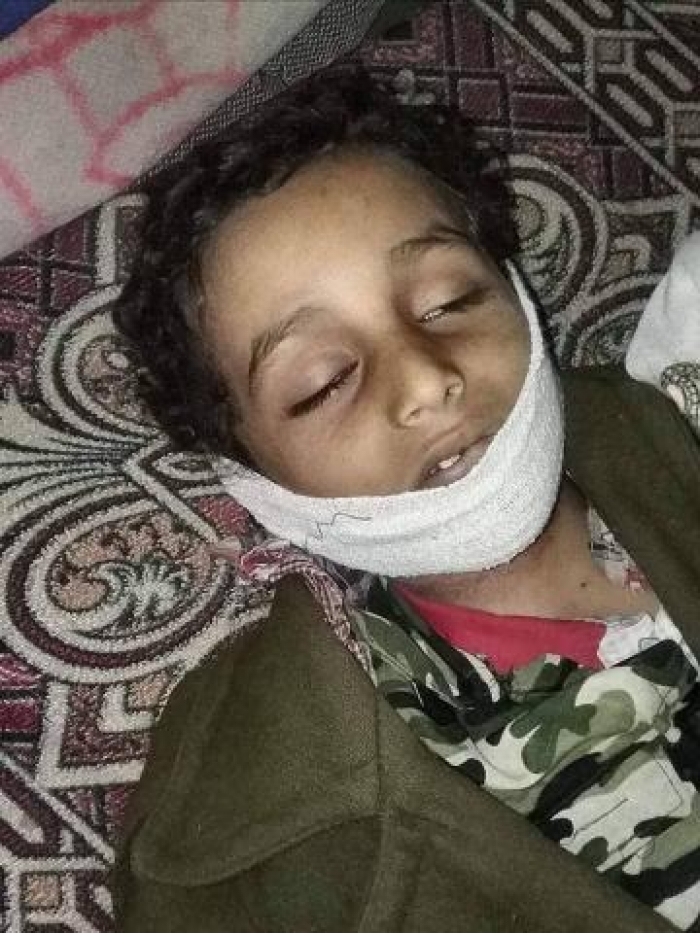 عمره 11سنة : طفل يمني يشنق نفسه والسبب .. لن تصدق ؟!